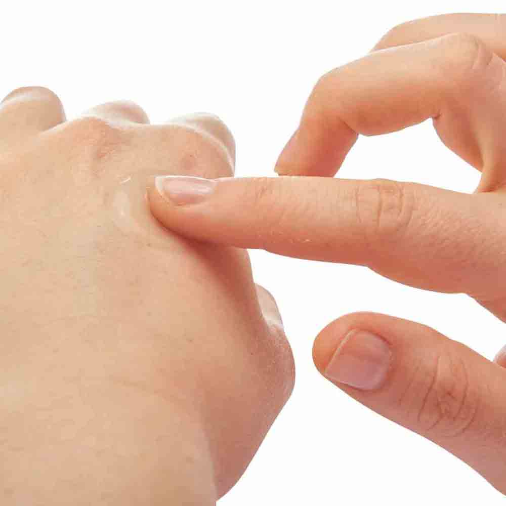 特強蚊叮止痕啫喱 (新舊包裝隨機發放) After Bite Xtra (Random packing)