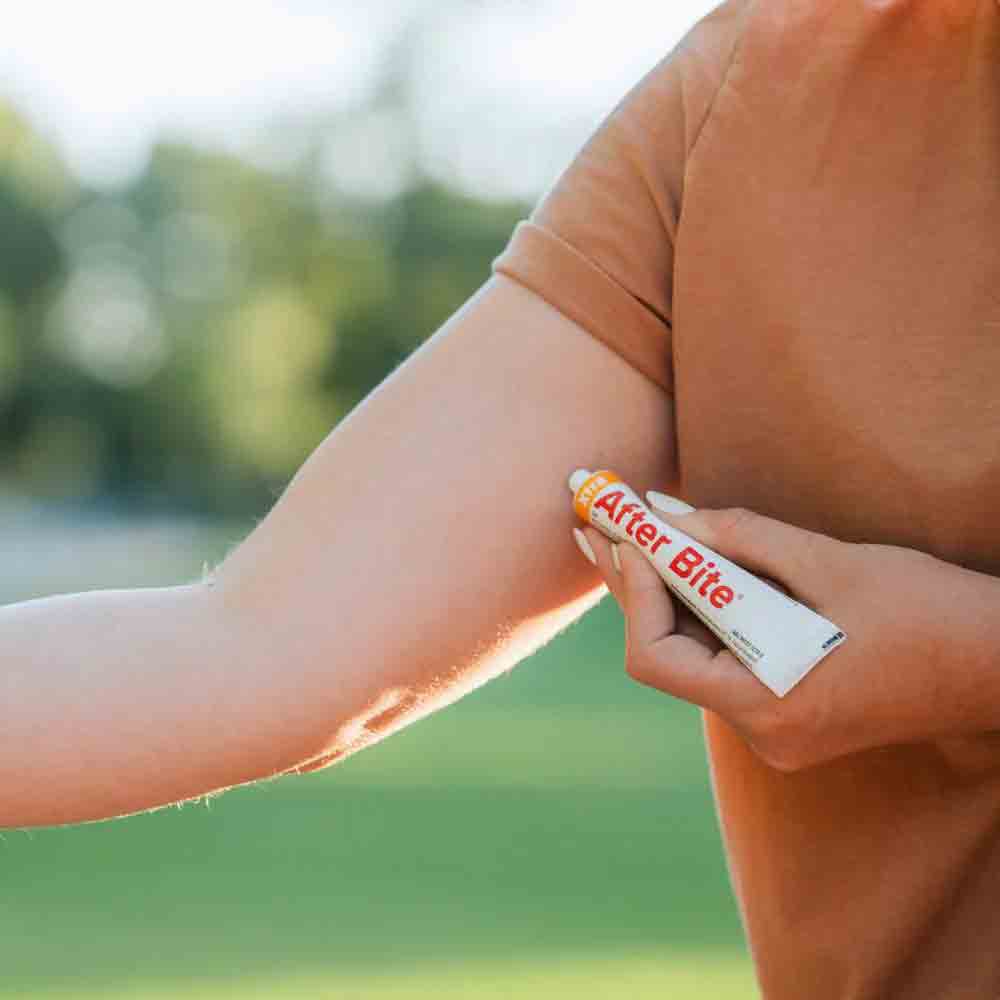 特強蚊叮止痕啫喱 (新舊包裝隨機發放) After Bite Xtra (Random packing)